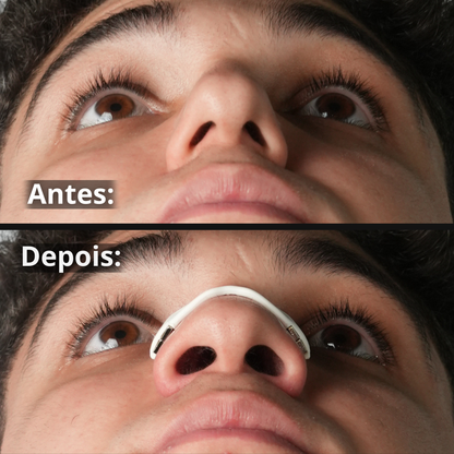 InspirePro® - Alargador Nasal